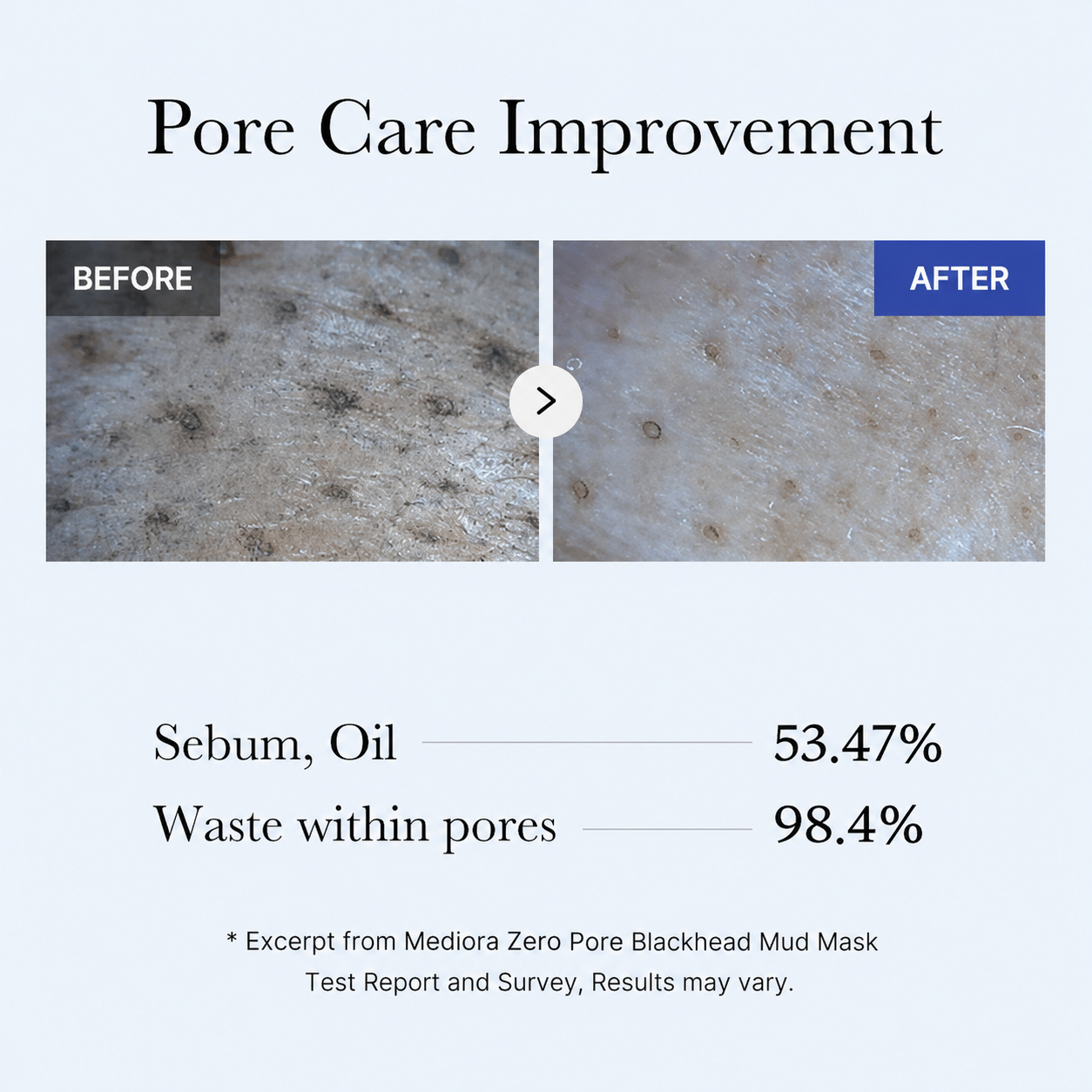 Mediora Zero Pore Blackhead Mud Mask 100g